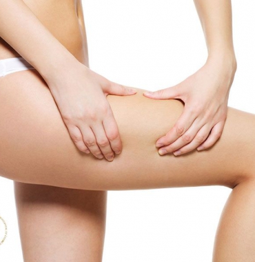 Lưu ý cần thiết khi thực hiện hút mỡ đùi