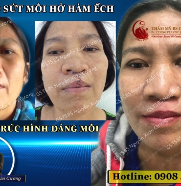 Từ công việc chăn nuôi đến công việc văn phòng nhờ thẩm mỹ điều trị sức môi