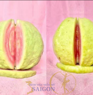 NHỮNG ĐIỀU CẦN BIẾT KHI THU NHỎ “CÔ BÉ”